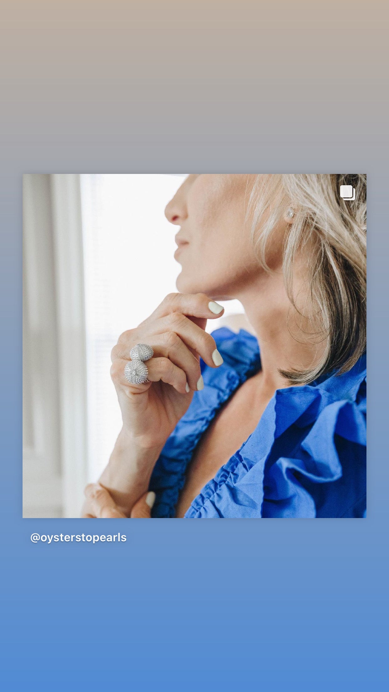 Mini Sea Urchin Cocktail Ring